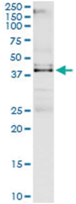 VRK1, Human, IP-WB Antibody Pair (PW3), Abnova&trade;