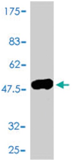 VSNL1, Mouse, Polyclonal Antibody, Abnova 50 &mu;L | Buy Online | Abnova | Fisher Scientific