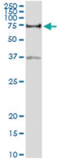 anti-VTN, Human, IP-WB Antibody Pair, Abnova&trade;
