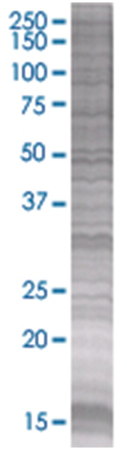 VWF 293T Cell Overexpression Lysate (Denatured), Abnova 100 &mu;L | Buy Online | Abnova | Fisher Scientific