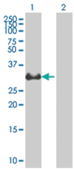 VWF 293T Cell Overexpression Lysate (Denatured), Abnova