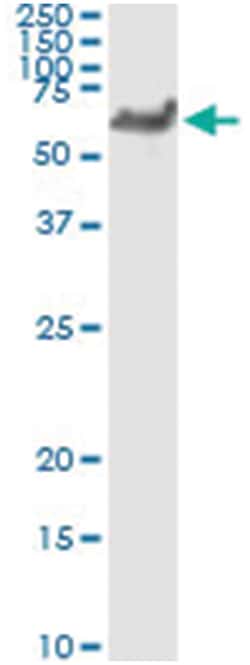 WARS, Human, IP-WB Antibody Pair (PW1), Abnova 1 Set:Antibodies, Monoclonal/Polyclonal