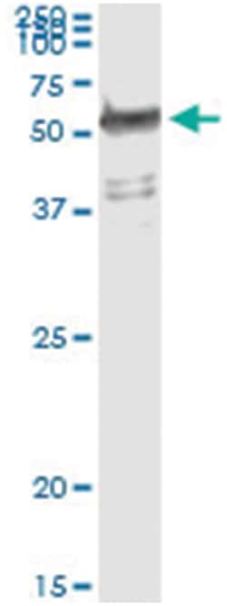 WARS, Human, IP-WB Antibody Pair (PW2), Abnova&trade;