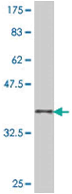 WAS, Mouse, Polyclonal Antibody, Abnova 50 &mu;L | Buy Online | Abnova Corporation | Fisher Scientific