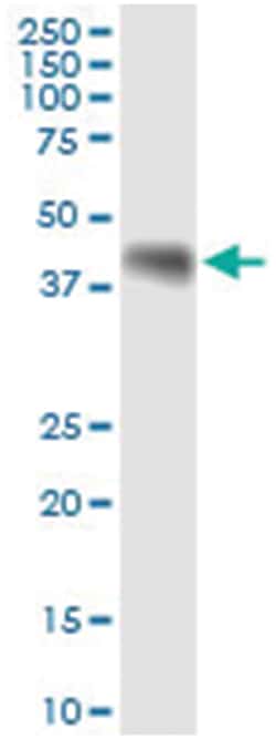 anti-WNT8A, Human, IP-WB Antibody Pair, Abnova&trade;