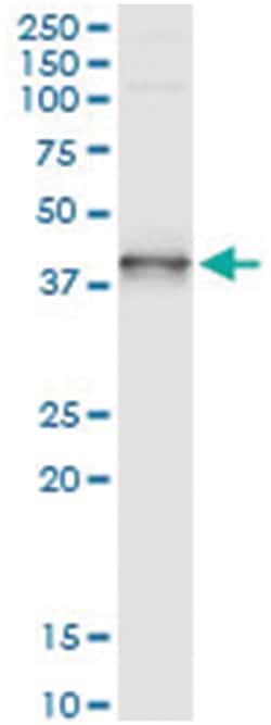 anti-XPA, Human, IP-WB Antibody Pair, Abnova&trade;