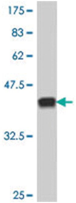 XPC, Mouse, Polyclonal Antibody, Abnova 50&mu;L; Unlabeled:Antibodies,