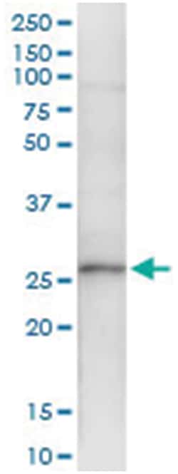 anti-XRCC3, Human, IP-WB Antibody Pair, Abnova&trade;