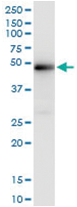 Abnova anti-XRCC4, Human, IP-WB Antibody Pair, Abnova™