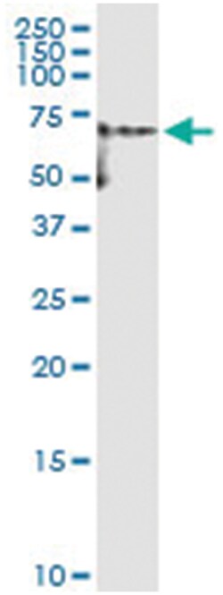 anti-YES1, Human, IP-WB Antibody Pair, Abnova 1 Set:Antibodies, Monoclonal/Polyclonal