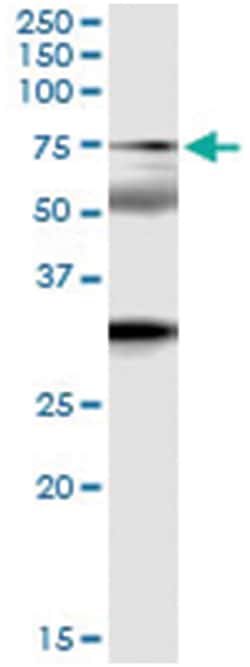 anti-ZNF18, Human, IP-WB Antibody Pair, Abnova 1 Set | Buy Online | Abnova Corporation | Fisher Scientific