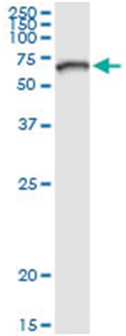 anti-ZNF182, Human, IP-WB Antibody Pair, Abnova™