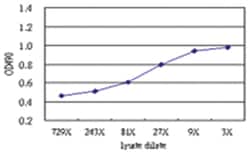 anti-ZSCAN20 Matched Antibody Pair, Abnova 1 Set, Unlabeled:Antibodies,