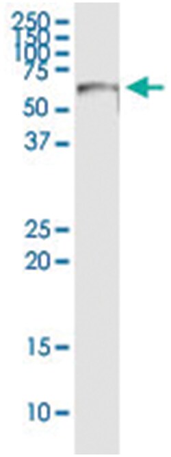 anti-ZSCAN20, Human, IP-WB Antibody Pair, Abnova&trade;