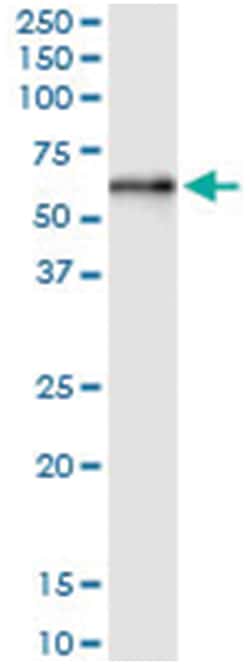 anti-ZSCAN21, Human, IP-WB Antibody Pair, Abnova™