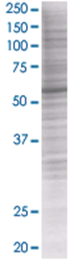 ZNF38 293T Cell Overexpression Lysate (Denatured), Abnova