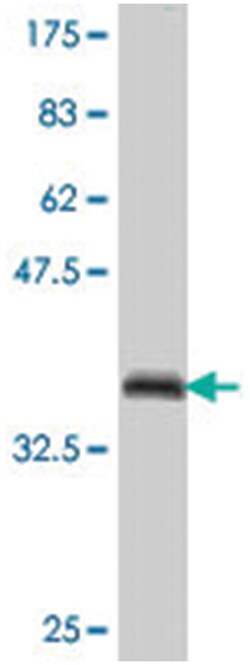 ZNF131, Mouse, Polyclonal Antibody, Abnova 50&mu;L; Unlabeled:Antibodies,
