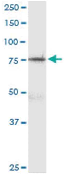 anti-ZNF131, Human, IP-WB Antibody Pair, Abnova 1 Set:Antibodies, Monoclonal/Polyclonal