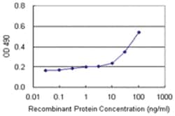 TRIM25, Human, Matched Antibody Pair (AP21), Abnova 1 set, Unlabeled:Antibodies,