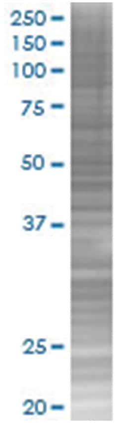 ZNF157 293T Cell Overexpression Lysate (Denatured), Abnova 100 &mu;L | Buy Online | Abnova | Fisher Scientific