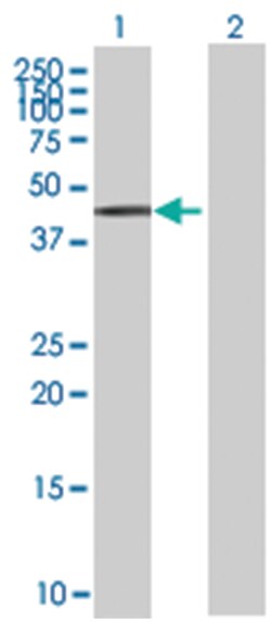 ZNF157 293T Cell Overexpression Lysate (Denatured), Abnova 100 &mu;L | Buy Online | Abnova | Fisher Scientific