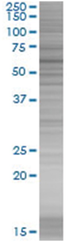 ZNF165 293T Cell Overexpression Lysate (Denatured), Abnova 100 &mu;l | Buy Online | Abnova | Fisher Scientific