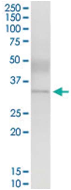 anti-ZNF215, Human, IP-WB Antibody Pair, Abnova 1 Set | Buy Online | Abnova Corporation | Fisher Scientific