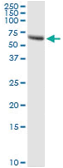 anti-ZNF232, Human, IP-WB Antibody Pair, Abnova&trade;