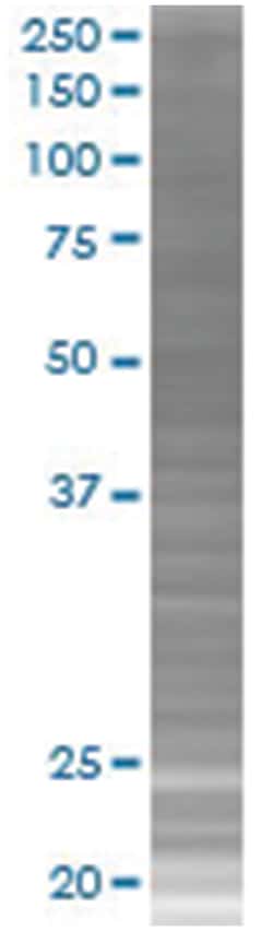 ZNF232 293T Cell Overexpression Lysate (Denatured), Abnova 100 &mu;L | Buy Online | Abnova | Fisher Scientific