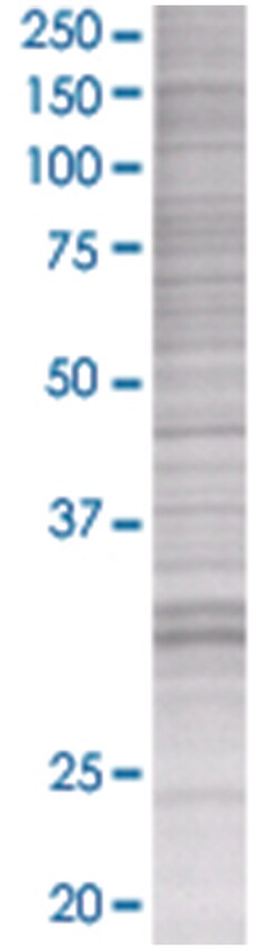 DNALI1 293T Cell Overexpression Lysate (Denatured), Abnova 100 &mu;L | Buy Online | Abnova | Fisher Scientific
