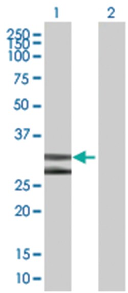 DNALI1 293T Cell Overexpression Lysate (Denatured), Abnova 100 &mu;L | Buy Online | Abnova | Fisher Scientific