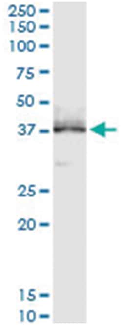 anti-NPHS2, Human, IP-WB Antibody Pair, Abnova&trade;