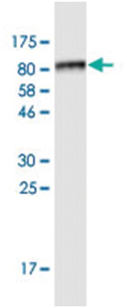 PAX8 (M09C), Mouse anti-Human, Clone: 3H7, Abnova 200 &mu;L | Buy Online | Abnova | Fisher Scientific