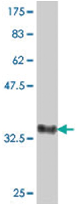 FZD5, Mouse, Polyclonal Antibody, Abnova 50 &mu;L | Buy Online | Abnova Corporation | Fisher Scientific