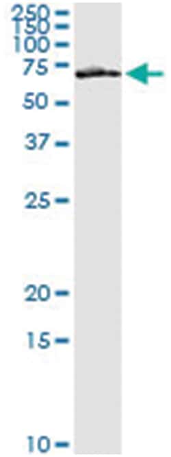 anti-FZD5, Human, IP-WB Antibody Pair, Abnova 1 Set:Antibodies, Monoclonal/Polyclonal