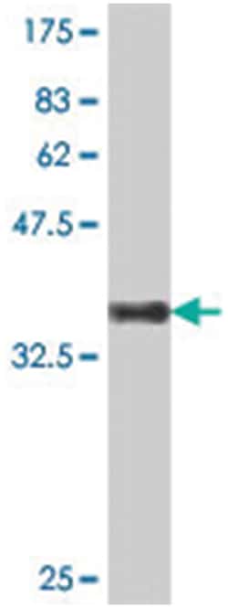 secretogranin II (chromogranin C), Mouse, Polyclonal Antibody, Abnova 50&mu;L;