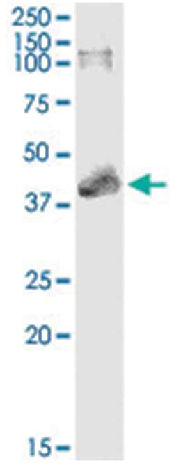 anti-MAPKAPK3, Human, IP-WB Antibody Pair, Abnova&trade;