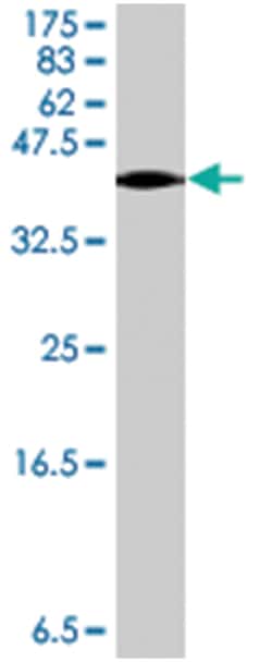 SEMA3B, Mouse, Polyclonal Antibody, Abnova 50 &mu;L | Buy Online | Abnova | Fisher Scientific