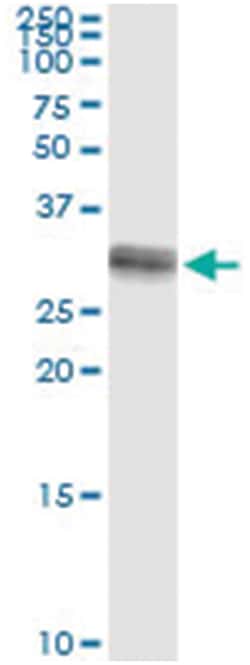 anti-HSD17B8, Human, IP-WB Antibody Pair, Abnova 1 Set:Antibodies, Monoclonal/Polyclonal
