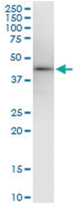 anti-EPM2A, Human, IP-WB Antibody Pair, Abnova 1 Set | Buy Online | Abnova Corporation | Fisher Scientific