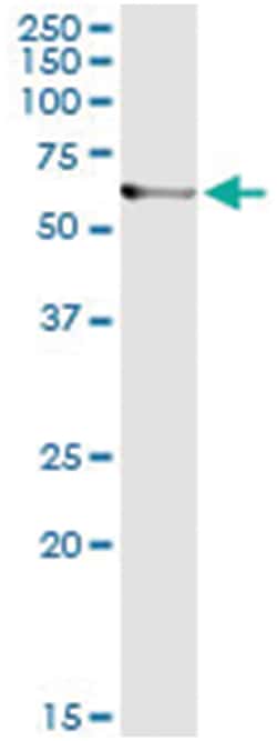 anti-ARHGEF5, Human, IP-WB Antibody Pair, Abnova™