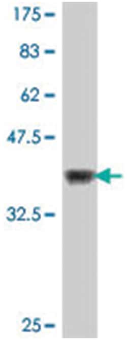 NR4A3, Mouse, Polyclonal Antibody, Abnova 50&mu;L; Unlabeled:Antibodies,