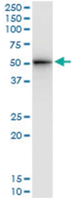 anti-STAM, Human, IP-WB Antibody Pair, Abnova 1 Set:Antibodies, Monoclonal/Polyclonal
