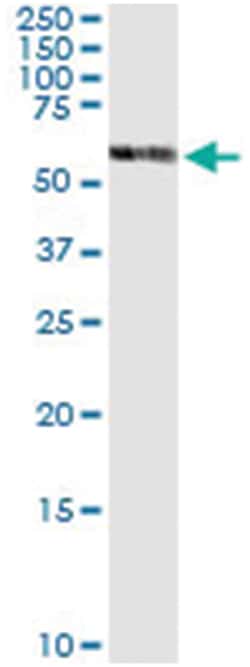 anti-PDHX, Human, IP-WB Antibody Pair, Abnova™
