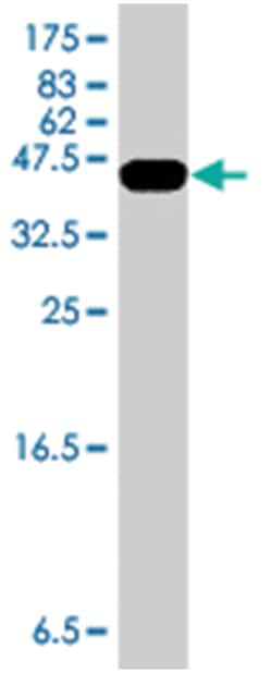 HMGA2, Mouse, Polyclonal Antibody, Abnova 50&mu;L; Unlabeled:Antibodies,