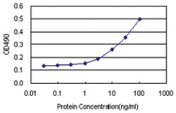 anti-TCL1A Matched Antibody Pair, Abnova 1 set, Unlabeled:Antibodies, Monoclonal/Polyclonal