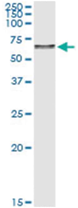anti-TAF15, Human, IP-WB Antibody Pair, Abnova™