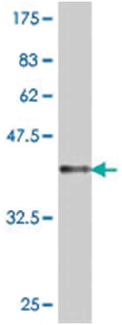 CLPP, Mouse, Polyclonal Antibody, Abnova 50&mu;L; Unlabeled:Antibodies,
