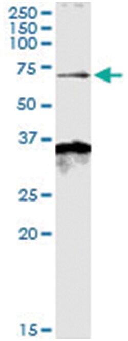 anti-MKKS, Human, IP-WB Antibody Pair, Abnova&trade;