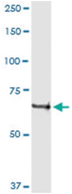anti-ACOX2, Human, IP-WB Antibody Pair, Abnova 1 Set:Antibodies, Monoclonal/Polyclonal